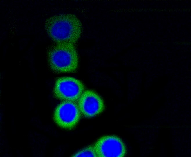 IF(ICC) staining with RPS3 (12A5) Monoclonal Antibody (bsm-52257R) at 1:100 in N2A cells (green). The nuclear counterstain is DAPI (blue). Cells were fixed in paraformaldehyde, permeabilized with 0.25% Triton X100/PBS.