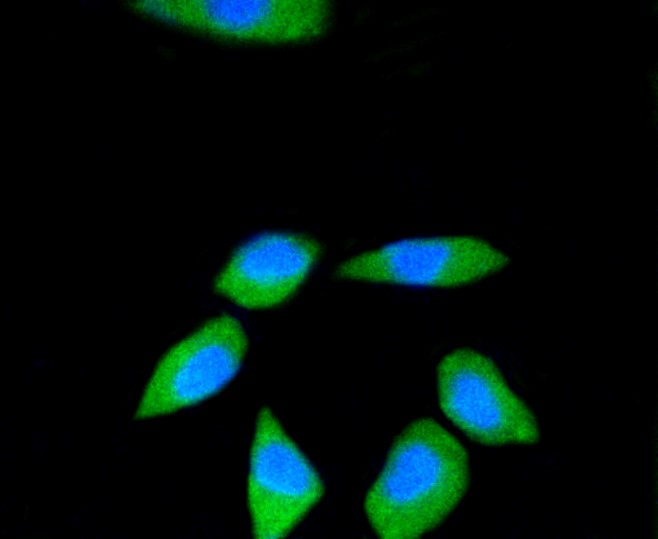 IF(ICC) staining with RPS3 (12A5) Monoclonal Antibody (bsm-52257R) at 1:100 in SH-SY5Y cells (green). The nuclear counterstain is DAPI (blue). Cells were fixed in paraformaldehyde, permeabilized with 0.25% Triton X100/PBS.