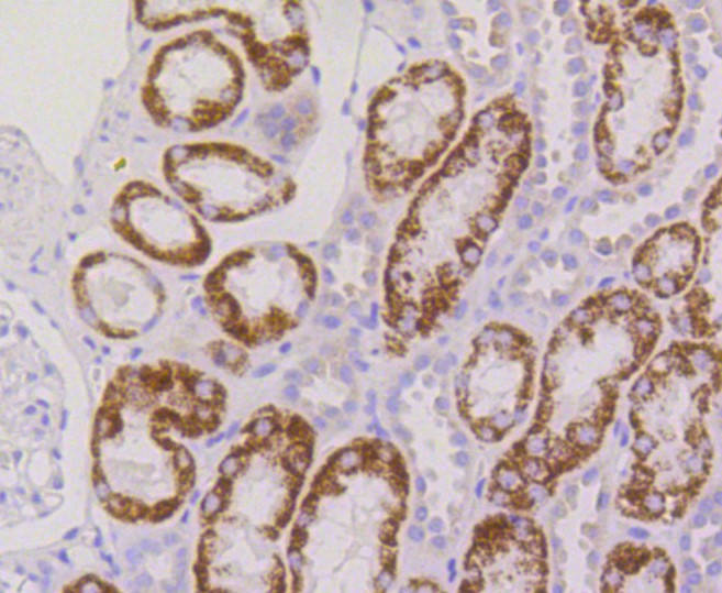Paraformaldehyde-fixed and paraffin-embedded Human kidney tissue incubated with RPS3 (12A5) Monoclonal Antibody (bsm-52257R) at 1:100, overnight at 4°C, followed by a conjugated secondary antibody and DAB staining. Counterstained with hematoxylin.