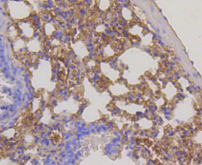 Paraformaldehyde-fixed and paraffin-embedded Mouse lung tissue incubated with RPS3 (12A5) Monoclonal Antibody (bsm-52257R) at 1:100, overnight at 4°C, followed by a conjugated secondary antibody and DAB staining. Counterstained with hematoxylin.