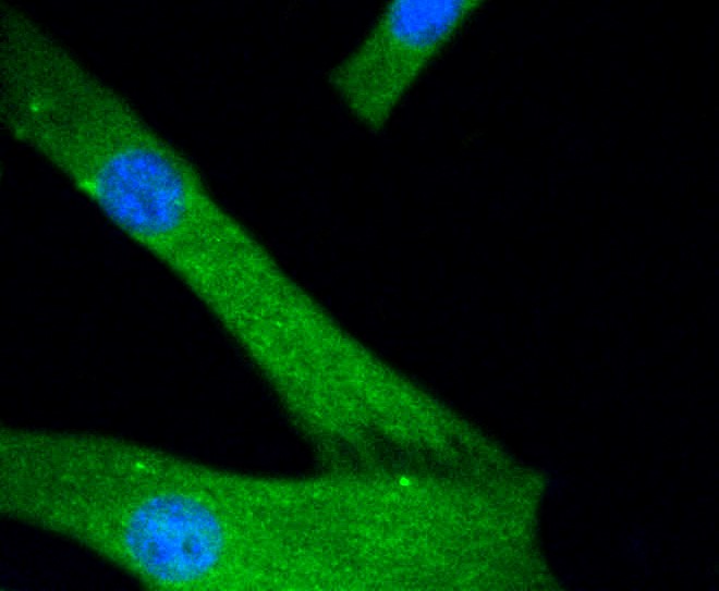 IF(ICC) staining with JNK1+JNK2+JNK3 (3G7) Monoclonal Antibody (bsm-52258R) at 1:100 in NIH/3T3 cells (green). The nuclear counterstain is DAPI (blue). Cells were fixed in paraformaldehyde, permeabilized with 0.25% Triton X100/PBS.