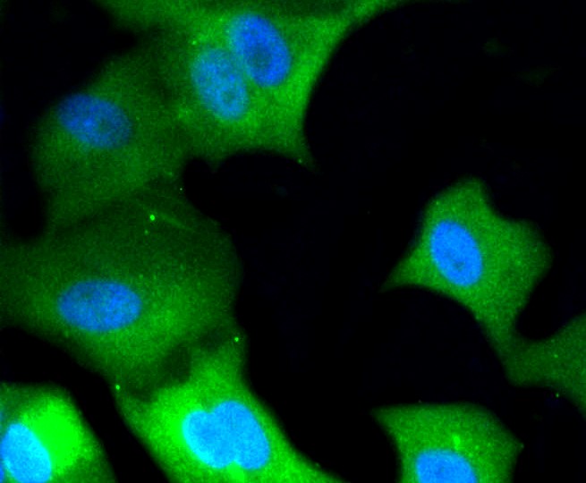 IF(ICC) staining with ERK1/2 (3A12) Monoclonal Antibody (bsm-52259R) at 1:100 in MCF-7 cells (green). The nuclear counterstain is DAPI (blue). Cells were fixed in paraformaldehyde, permeabilized with 0.25% Triton X100/PBS.