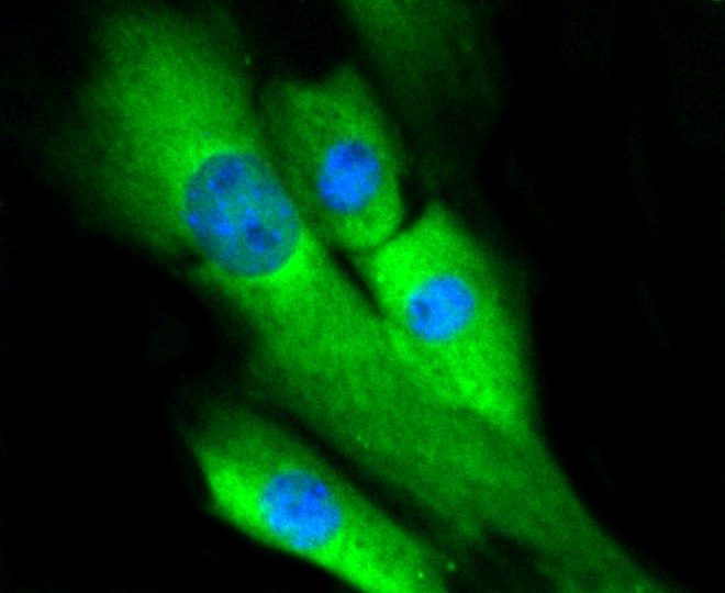 IF(ICC) staining with ERK1/2 (3A12) Monoclonal Antibody (bsm-52259R) at 1:100 in NIH/3T3 cells (green). The nuclear counterstain is DAPI (blue). Cells were fixed in paraformaldehyde, permeabilized with 0.25% Triton X100/PBS.