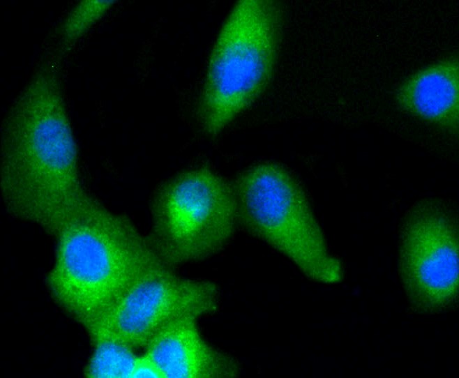 IF(ICC) staining with ERK1/2 (3A12) Monoclonal Antibody (bsm-52259R) at 1:100 in A549 cells (green). The nuclear counterstain is DAPI (blue). Cells were fixed in paraformaldehyde, permeabilized with 0.25% Triton X100/PBS.