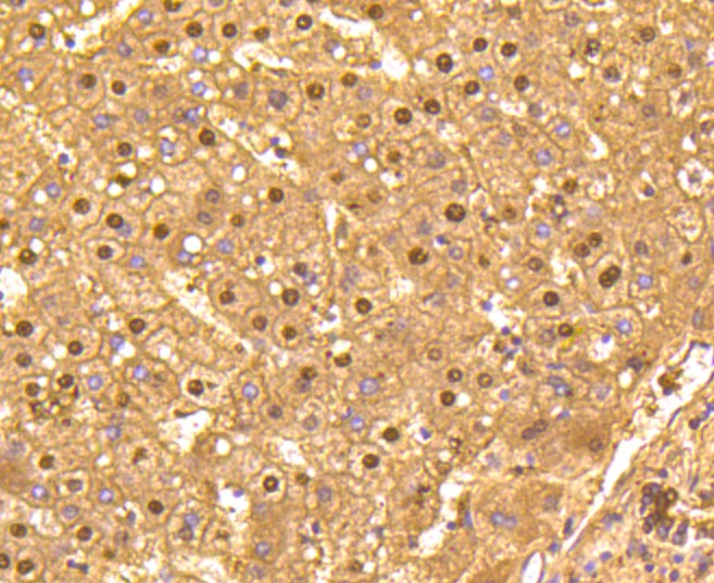 Paraformaldehyde-fixed and paraffin-embedded Human liver tissue incubated with GAPDH (3B5) Monoclonal Antibody (bsm-52262R) at 1:100, overnight at 4°C, followed by a conjugated secondary antibody and DAB staining. Counterstained with hematoxylin.