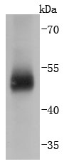 Human lung Probed with Carbonic anhydrase 9 (7C4) Monoclonal Antibody (bsm-52738R) at 1:1000 overnight at 4°C followed by a conjugated secondary antibody for 60 minutes at 37°C. Human lung Probed with Carbonic anhydrase 9 (7C4) Monoclonal Antibody (bsm-52738R) at 1:1000 overnight at 4°C followed by a conjugated secondary antibody for 60 minutes at 37°C.