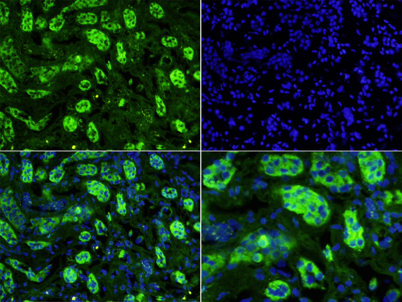Paraformaldehyde-fixed, paraffin-embedded Human Kidney tissue; Antigen retrieval by boiling in sodium citrate buffer (0.01M, pH 6.0) for 15min; Blocking buffer (normal goat serum) at 37°C for 20min; Antibody incubation with Uromodulin Polyclonal Antibody, Unconjugated (bs-2189R) at 1:200 overnight at 4°C. A Goat Anti-Rabbit IgG, FITC Conjugated secondary antibody (bs-0295G-FITC) was used for 40 mins at 37°C. DAPI (5ug/ml, blue) was used for nuclei staining.