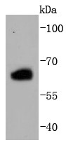 293T cell lysate probed with Estrogen Receptor beta (2C2) Monoclonal Antibody (bsm-52755R) at 1:1000 overnight at 4°C followed by a conjugated secondary antibody for 60 minutes at 37°C. 293T cell lysate probed with Estrogen Receptor beta (2C2) Monoclonal Antibody (bsm-52755R) at 1:1000 overnight at 4°C followed by a conjugated secondary antibody for 60 minutes at 37°C.