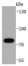 Hela cells Probed with RIP (9C3) Monoclonal Antibody (bsm-52766RR) at 1:1000 overnight at 4°C followed by a conjugated secondary antibody for 60 minutes at 37°C.