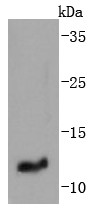 Human placenta Probed with IGF2 (1T3) Monoclonal Antibody (bsm-52776R) at 1:1000 overnight at 4°C followed by a conjugated secondary antibody for 60 minutes at 37°C. Human placenta Probed with IGF2 (1T3) Monoclonal Antibody (bsm-52776R) at 1:1000 overnight at 4°C followed by a conjugated secondary antibody for 60 minutes at 37°C.