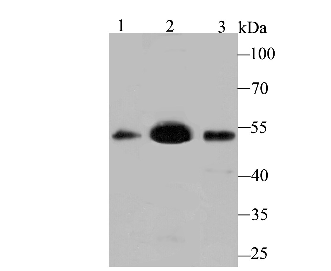 Lane 1: Mouse Testis; Lane 2: SH-SY5Y Cells; Lane 3: Mouse Lung; Probed with MEIS2 (3C2) Monoclonal Antibody (bsm-54251R) at 1:500 overnight at 4°C followed by a conjugated secondary antibody for 60 minutes at 37°C.
