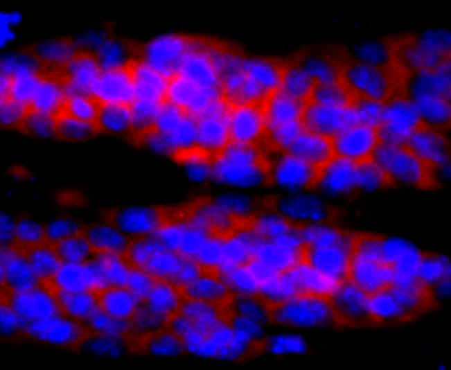 Interleukin-4 (3F4) Monoclonal Antibody – Bioss