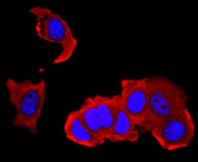 IF(ICC) staining with Interleukin-4 (3F4) Monoclonal Antibody (bsm-54002R) at 1:100 in MCF-7 cells (red). The nuclear counterstain is DAPI (blue). Cells were fixed in paraformaldehyde, permeabilized with 0.25% Triton X100/PBS.