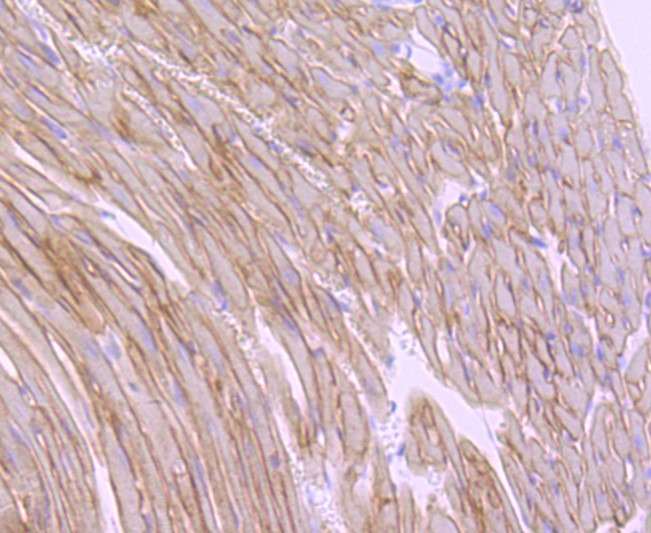 Paraformaldehyde-fixed and paraffin-embedded Mouse heart tissue incubated with alpha sarcoglycan (5H4) Monoclonal Antibody (bsm-52999R) at 1:100, overnight at 4°C, followed by a conjugated secondary antibody and DAB staining. Counterstained with hematoxylin.