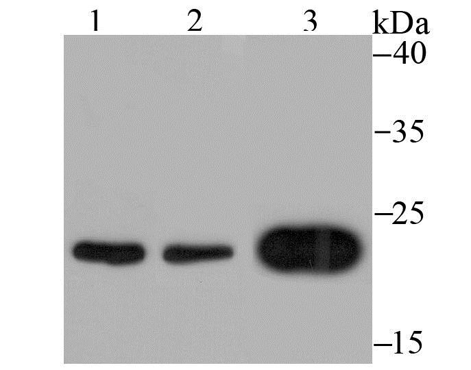 Lane 1: K562 Cells; Lane 2: 293T Cells; Lane 3: SH-SY5Y Cells; Probed with MAD2L1 (6C6) Monoclonal Antibody (bsm-54219R) at 1:500 overnight at 4°C followed by a conjugated secondary antibody for 60 minutes at 37°C.