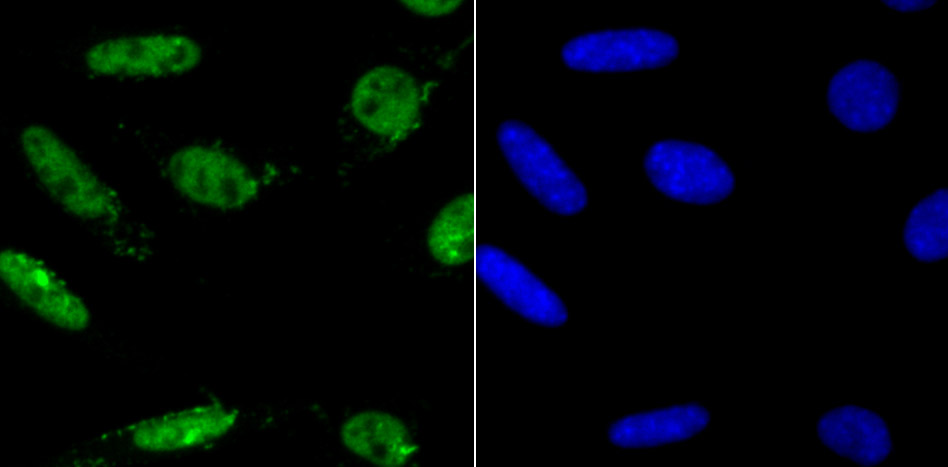 IF(ICC) staining with MAD2L1 (6C6) Monoclonal Antibody (bsm-54219R) at 1:200 in SH-SY5Y cells (green). The nuclear counterstain is DAPI (blue). Cells were fixed in paraformaldehyde, permeabilized with 0.25% Triton X100/PBS.