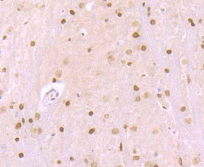 Paraformaldehyde-fixed and paraffin-embedded Mouse Brain tissue incubated with MAD2L1 (6C6) Monoclonal Antibody (bsm-54219R) at 1:100, overnight at 4°C, followed by a conjugated secondary antibody and DAB staining. Counterstained with hematoxylin.
