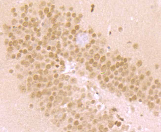 Paraformaldehyde-fixed and paraffin-embedded Mouse Hippocampus tissue incubated with MAD2L1 (6C6) Monoclonal Antibody (bsm-54219R) at 1:100, overnight at 4°C, followed by a conjugated secondary antibody and DAB staining. Counterstained with hematoxylin.