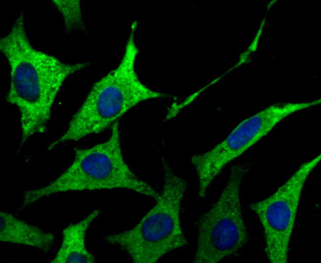 IF(ICC) staining with GAB1 (13C4) Monoclonal Antibody (bsm-54220R) at 1:200 in SH-SY5Y cells (green). The nuclear counterstain is DAPI (blue). Cells were fixed in paraformaldehyde, permeabilized with 0.25% Triton X100/PBS.