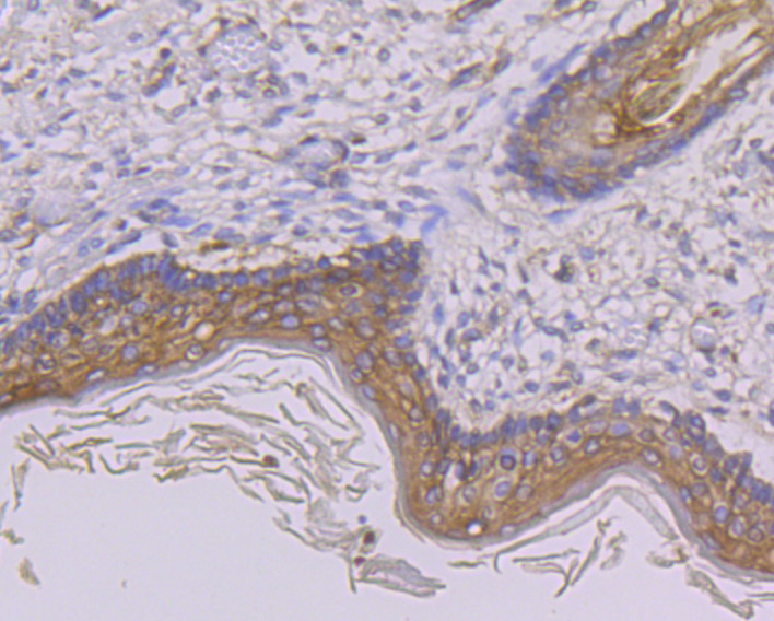 Paraformaldehyde-fixed and paraffin-embedded Human Skin tissue incubated with GAB1 (13C4) Monoclonal Antibody (bsm-54220R) at 1:100, overnight at 4°C, followed by a conjugated secondary antibody and DAB staining. Counterstained with hematoxylin.