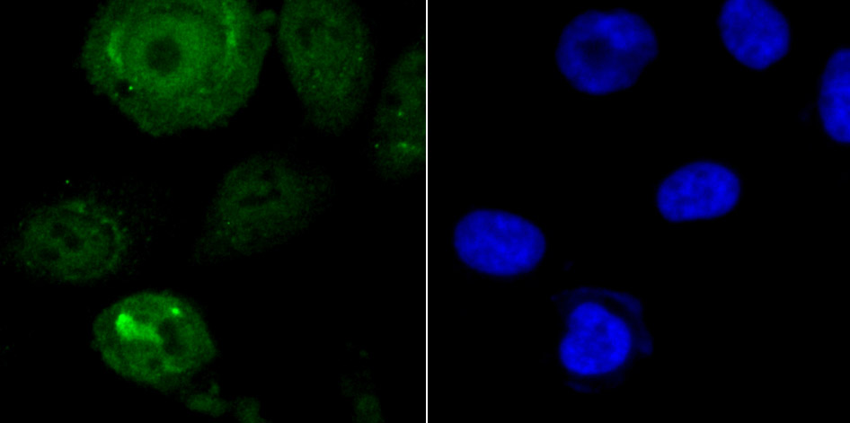 IF(ICC) staining with ENDOG (2C1) Monoclonal Antibody (bsm-54227R) at 1:100 in PC-3M cells (green). The nuclear counterstain is DAPI (blue). Cells were fixed in paraformaldehyde, permeabilized with 0.25% Triton X100/PBS.