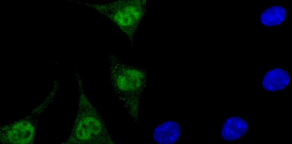 IF(ICC) staining with ENDOG (2C1) Monoclonal Antibody (bsm-54227R) at 1:100 in SH-SY5Y cells (green). The nuclear counterstain is DAPI (blue). Cells were fixed in paraformaldehyde, permeabilized with 0.25% Triton X100/PBS.