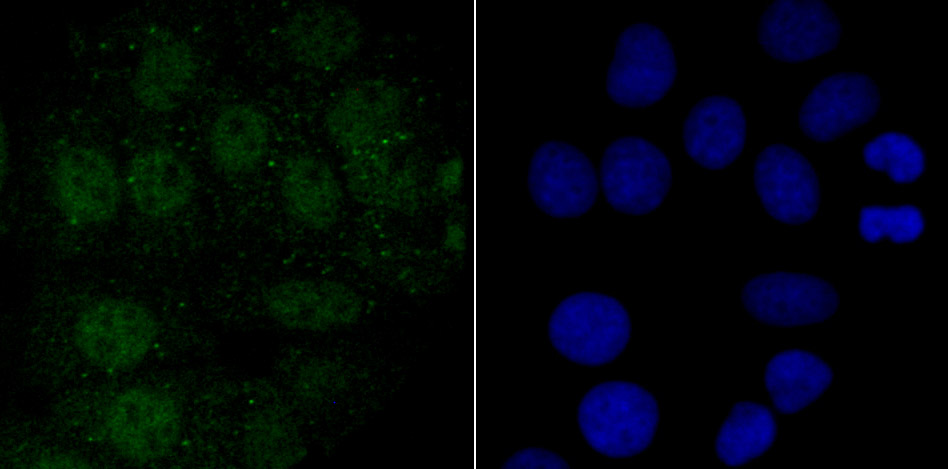 IF(ICC) staining with ENDOG (2C1) Monoclonal Antibody (bsm-54227R) at 1:100 in MCF-7 cells (green). The nuclear counterstain is DAPI (blue). Cells were fixed in paraformaldehyde, permeabilized with 0.25% Triton X100/PBS.