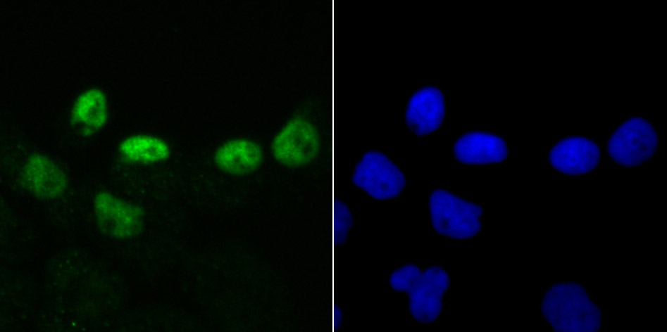 IF(ICC) staining with DKC1 (5C7) Monoclonal Antibody (bsm-54241R) at 1:100 in A431 cells (green). The nuclear counterstain is DAPI (blue). Cells were fixed in paraformaldehyde, permeabilized with 0.25% Triton X100/PBS.