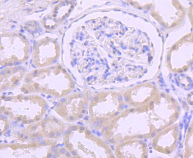 Paraformaldehyde-fixed and paraffin-embedded Human Kidney tissue incubated with DKC1 (5C7) Monoclonal Antibody (bsm-54241R) at 1:100, overnight at 4°C, followed by a conjugated secondary antibody and DAB staining. Counterstained with hematoxylin.