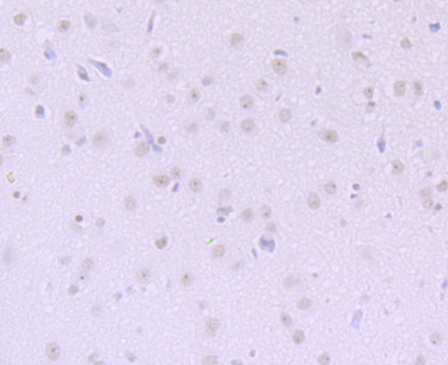 Paraformaldehyde-fixed and paraffin-embedded Rat Brain tissue incubated with DKC1 (5C7) Monoclonal Antibody (bsm-54241R) at 1:100, overnight at 4°C, followed by a conjugated secondary antibody and DAB staining. Counterstained with hematoxylin.