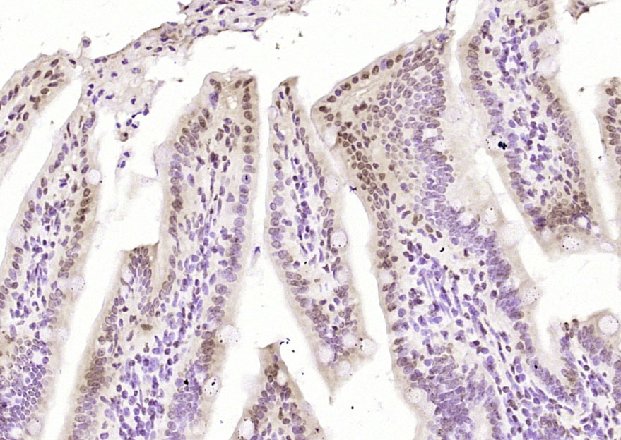 Paraformaldehyde-fixed, paraffin embedded Mouse intestine; Antigen retrieval by boiling in sodium citrate buffer (pH6.0) for 15min; Block endogenous peroxidase by 3% hydrogen peroxide for 20 minutes; Blocking buffer (normal goat serum) at 37°C for 30min; Antibody incubation with FBP1 Polyclonal Antibody, Unconjugated (bs-13224R) at 1:200 overnight at 4°C, DAB staining.
