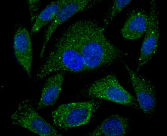 IF(ICC) staining with PSME1 (1C4) Monoclonal Antibody (bsm-54246R) at 1:100 in PC-3M cells (green). The nuclear counterstain is DAPI (blue). Cells were fixed in paraformaldehyde, permeabilized with 0.25% Triton X100/PBS.