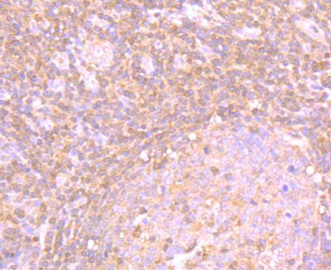 Paraformaldehyde-fixed and paraffin-embedded Human Tonsil tissue incubated with PSME1 (1C4) Monoclonal Antibody (bsm-54246R) at 1:100, overnight at 4°C, followed by a conjugated secondary antibody and DAB staining. Counterstained with hematoxylin.