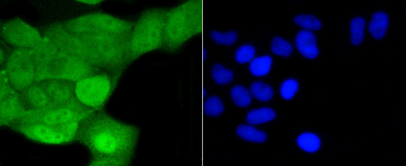 IF(ICC) staining with PTPN6 (1A5) Monoclonal Antibody (bsm-52271R) at 1:100 in HeLa cells (green). The nuclear counterstain is DAPI (blue). Cells were fixed in paraformaldehyde, permeabilized with 0.25% Triton X100/PBS.
