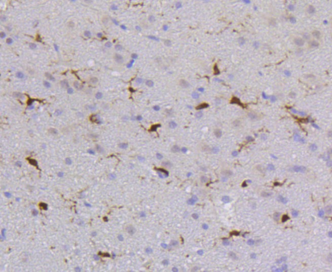 Paraformaldehyde-fixed and paraffin-embedded Rat brain tissue incubated with PTPN6 (1A5) Monoclonal Antibody (bsm-52271R) at 1:100, overnight at 4°C, followed by a conjugated secondary antibody and DAB staining. Counterstained with hematoxylin.