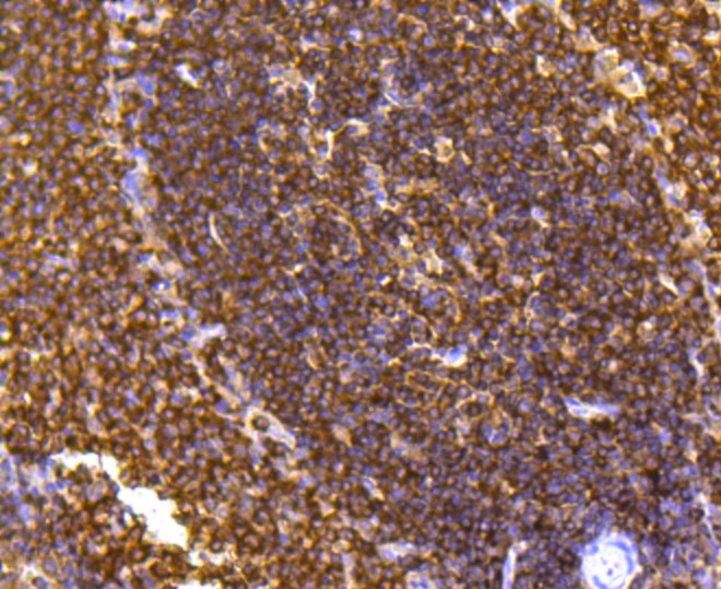 Paraformaldehyde-fixed and paraffin-embedded Rat spleen tissue incubated with PTPN6 (1A5) Monoclonal Antibody (bsm-52271R) at 1:100, overnight at 4°C, followed by a conjugated secondary antibody and DAB staining. Counterstained with hematoxylin.