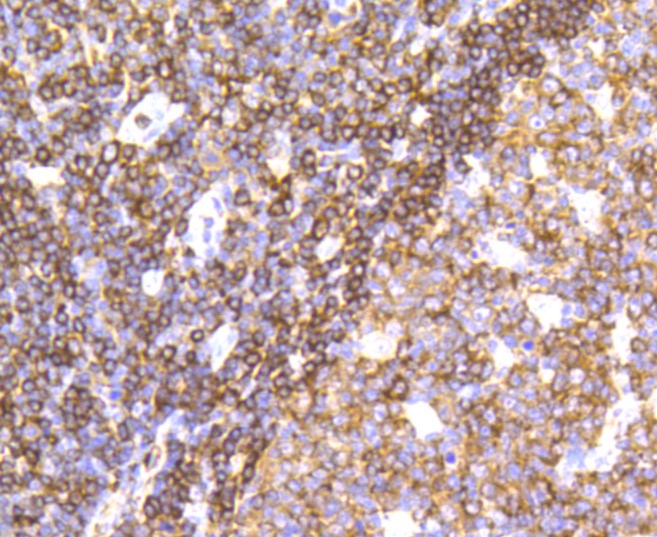 Paraformaldehyde-fixed and paraffin-embedded Human tonsil tissue incubated with PTPN6 (1A5) Monoclonal Antibody (bsm-52271R) at 1:100, overnight at 4°C, followed by a conjugated secondary antibody and DAB staining. Counterstained with hematoxylin.