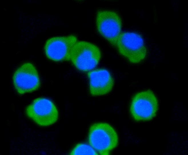 IF(ICC) staining with DLG4 (1H8) Monoclonal Antibody (bsm-52272R) at 1:100 in N2A cells (green). The nuclear counterstain is DAPI (blue). Cells were fixed in paraformaldehyde, permeabilized with 0.25% Triton X100/PBS.