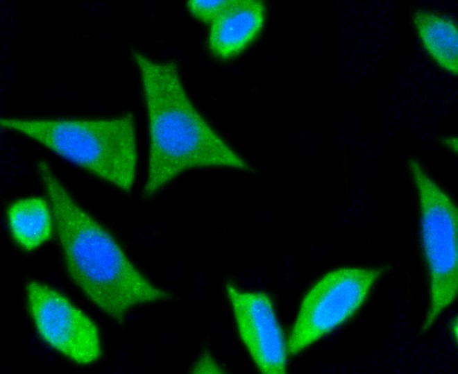 IF(ICC) staining with DLG4 (1H8) Monoclonal Antibody (bsm-52272R) at 1:100 in SH-SY5Y cells (green). The nuclear counterstain is DAPI (blue). Cells were fixed in paraformaldehyde, permeabilized with 0.25% Triton X100/PBS.