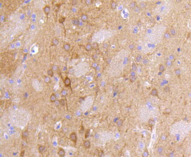 Paraformaldehyde-fixed and paraffin-embedded Rat brain tissue incubated with DLG4 (1H8) Monoclonal Antibody (bsm-52272R) at 1:100, overnight at 4°C, followed by a conjugated secondary antibody and DAB staining. Counterstained with hematoxylin.