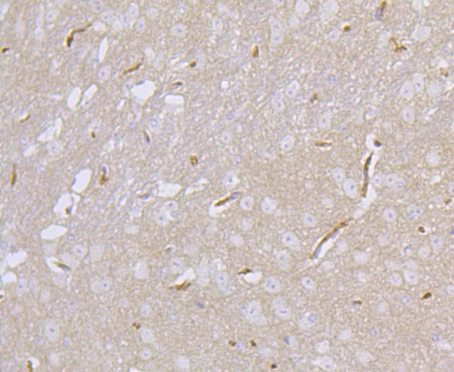 Paraformaldehyde-fixed and paraffin-embedded Mouse cerebellum tissue incubated with DLG4 (1H8) Monoclonal Antibody (bsm-52272R) at 1:100, overnight at 4°C, followed by a conjugated secondary antibody and DAB staining. Counterstained with hematoxylin.