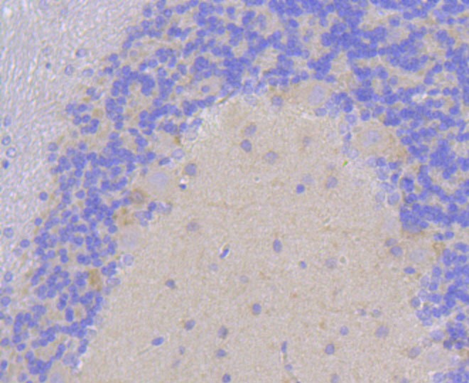 Paraformaldehyde-fixed and paraffin-embedded Rat cerebellum tissue incubated with DLG4 (1H8) Monoclonal Antibody (bsm-52272R) at 1:100, overnight at 4°C, followed by a conjugated secondary antibody and DAB staining. Counterstained with hematoxylin.