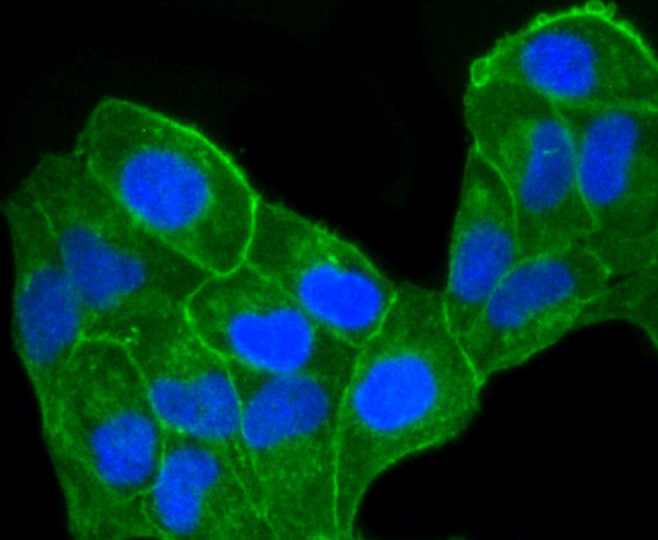 IF(ICC) staining with CCR7 (1G8) Monoclonal Antibody (bsm-52274R) at 1:100 in HeLa cells (green). The nuclear counterstain is DAPI (blue). Cells were fixed in paraformaldehyde, permeabilized with 0.25% Triton X100/PBS.