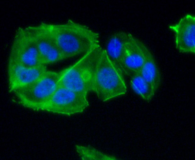 IF(ICC) staining with CCR7 (1G8) Monoclonal Antibody (bsm-52274R) at 1:100 in MCF-7 cells (green). The nuclear counterstain is DAPI (blue). Cells were fixed in paraformaldehyde, permeabilized with 0.25% Triton X100/PBS.