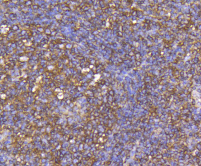 Paraformaldehyde-fixed and paraffin-embedded Human tonsil tissue incubated with CCR7 (1G8) Monoclonal Antibody (bsm-52274R) at 1:100, overnight at 4°C, followed by a conjugated secondary antibody and DAB staining. Counterstained with hematoxylin.