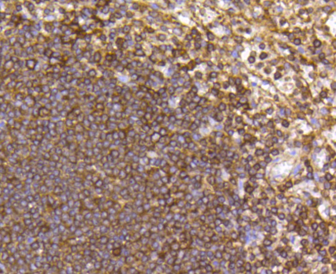 Paraformaldehyde-fixed and paraffin-embedded Human spleen tissue incubated with CCR7 (1G8) Monoclonal Antibody (bsm-52274R) at 1:100, overnight at 4°C, followed by a conjugated secondary antibody and DAB staining. Counterstained with hematoxylin.