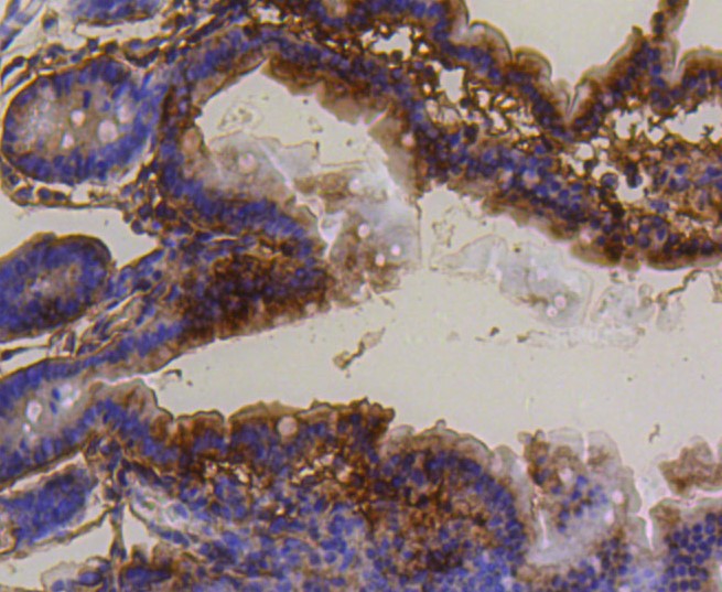 Paraformaldehyde-fixed and paraffin-embedded Mouse small intestine tissue incubated with PUMA (2G6) Monoclonal Antibody (bsm-52276R) at 1:100, overnight at 4°C, followed by a conjugated secondary antibody and DAB staining. Counterstained with hematoxylin.