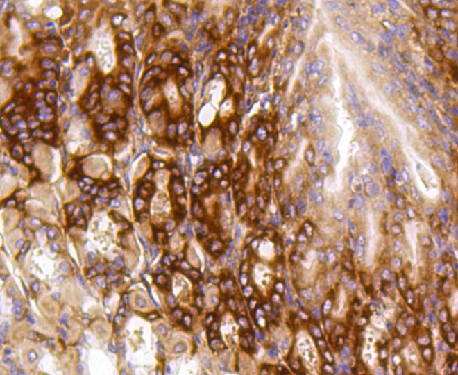 Paraformaldehyde-fixed and paraffin-embedded Mouse stomach tissue incubated with PUMA (2G6) Monoclonal Antibody (bsm-52276R) at 1:100, overnight at 4°C, followed by a conjugated secondary antibody and DAB staining. Counterstained with hematoxylin.