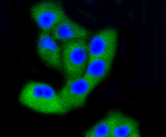 IF(ICC) staining with PTK2 (2F4) Monoclonal Antibody (bsm-52277R) at 1:100 in PANC-1 cells (green). The nuclear counterstain is DAPI (blue). Cells were fixed in paraformaldehyde, permeabilized with 0.25% Triton X100/PBS.