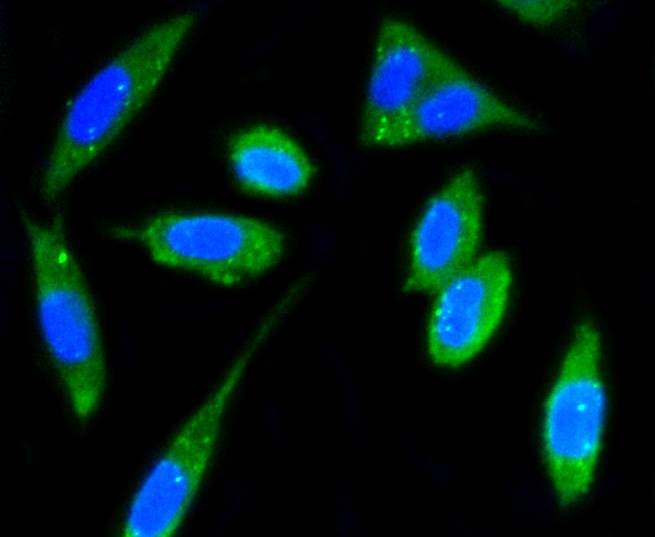 IF(ICC) staining with PTK2 (2F4) Monoclonal Antibody (bsm-52277R) at 1:100 in SH-SY5Y cells (green). The nuclear counterstain is DAPI (blue). Cells were fixed in paraformaldehyde, permeabilized with 0.25% Triton X100/PBS.
